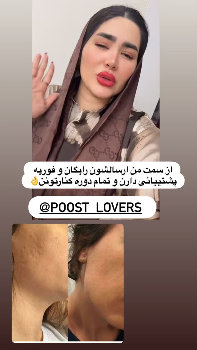  جدید ترین استوری اینستاگرام محی