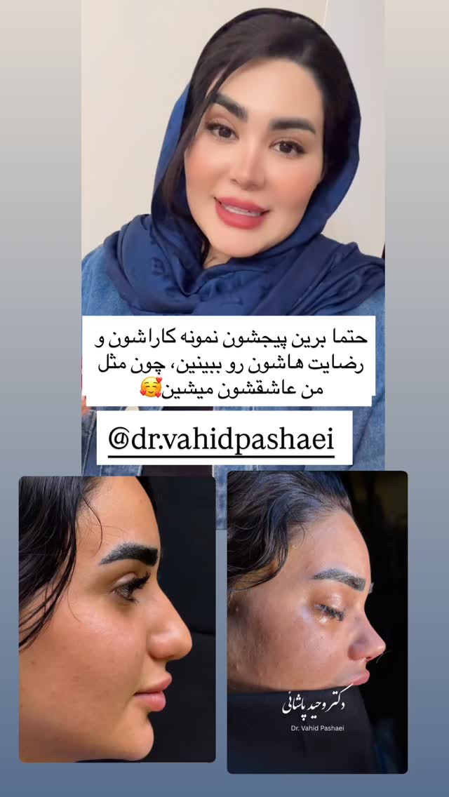  جدید ترین استوری اینستاگرام محی