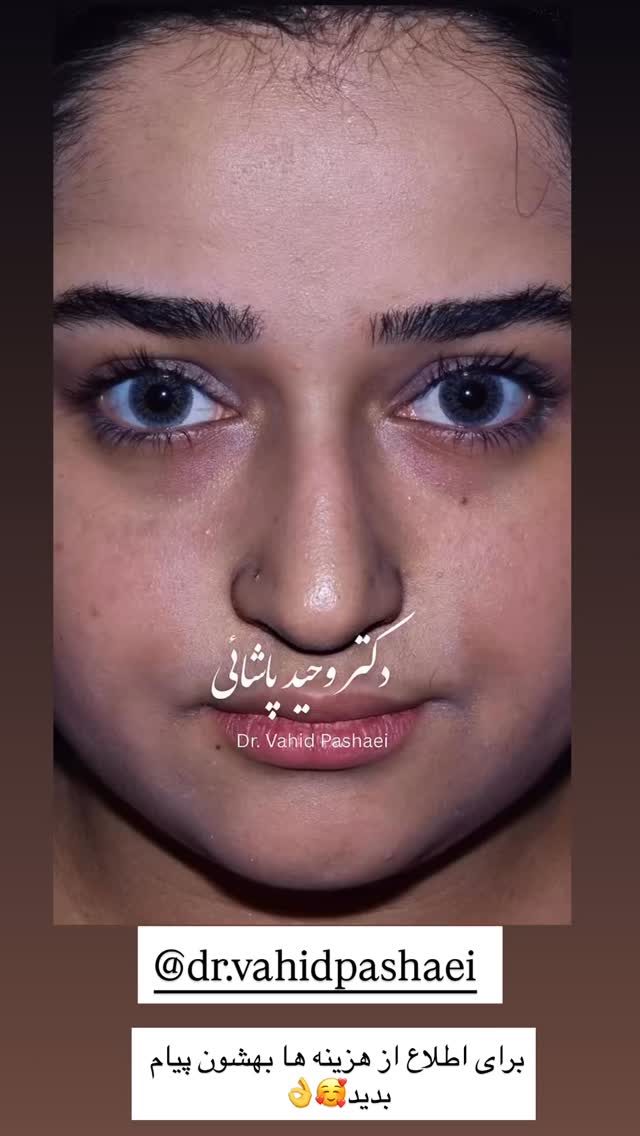  جدید ترین استوری اینستاگرام محی