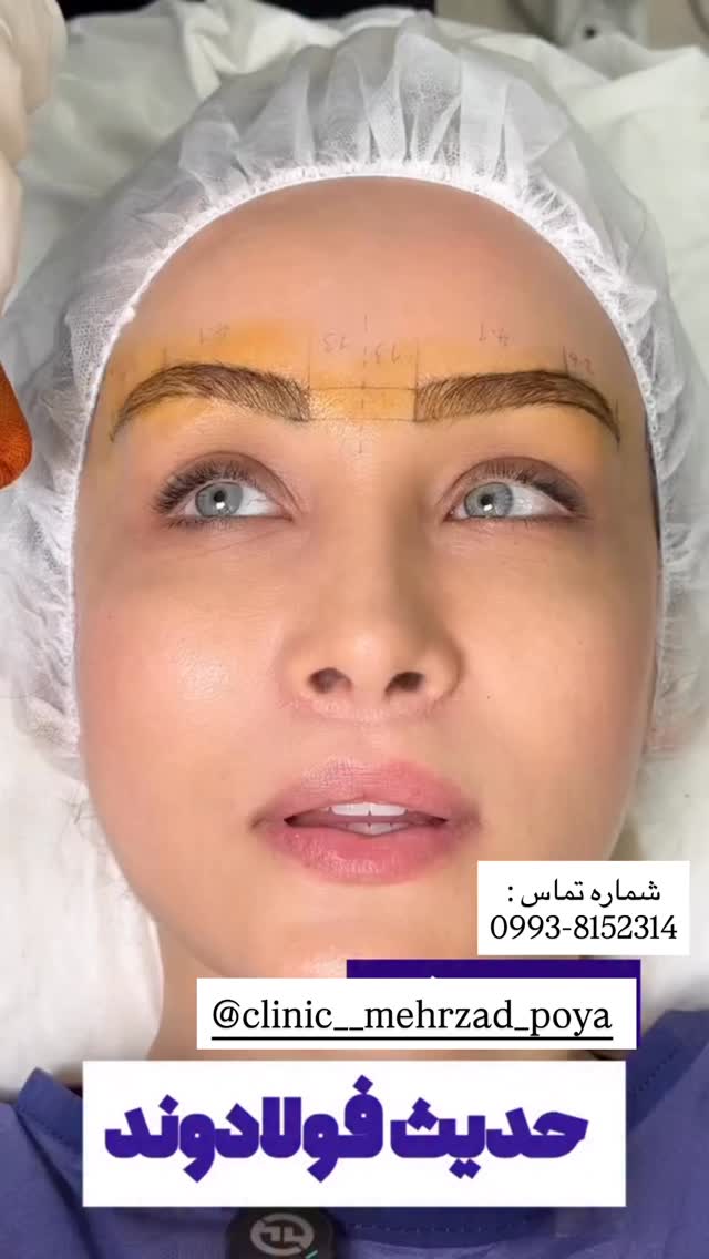  جدید ترین استوری اینستاگرام محی