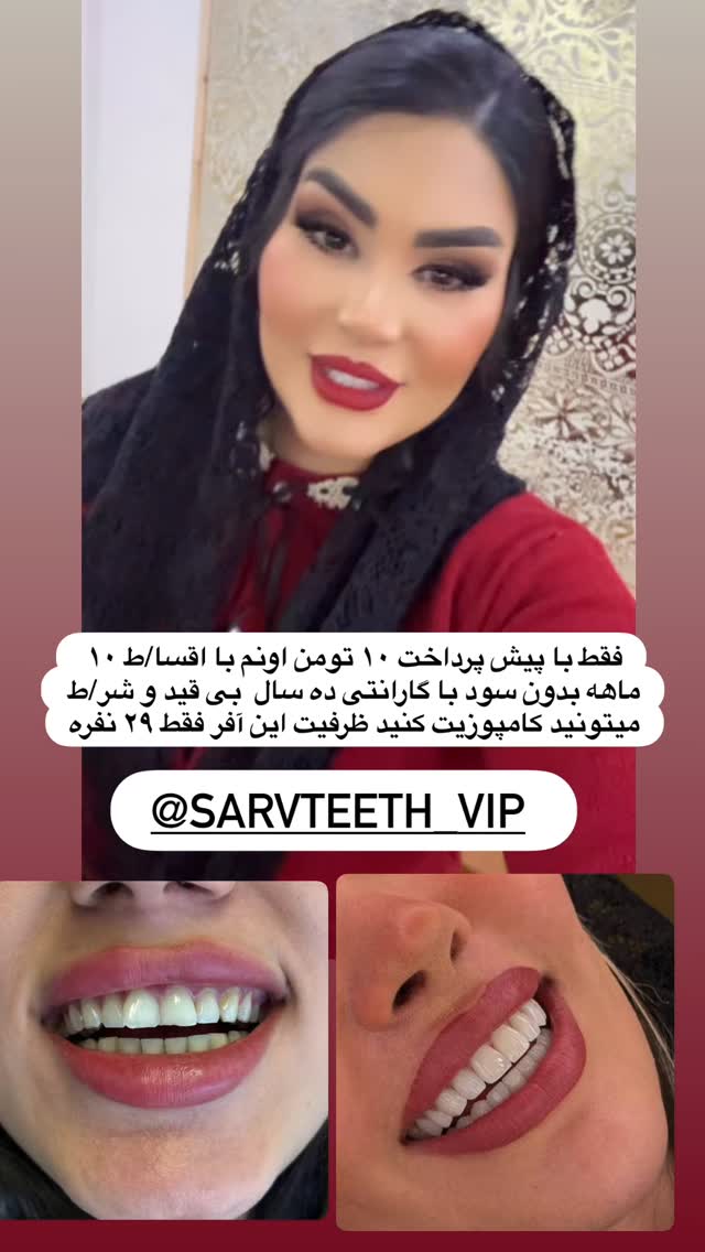  جدید ترین استوری اینستاگرام محی