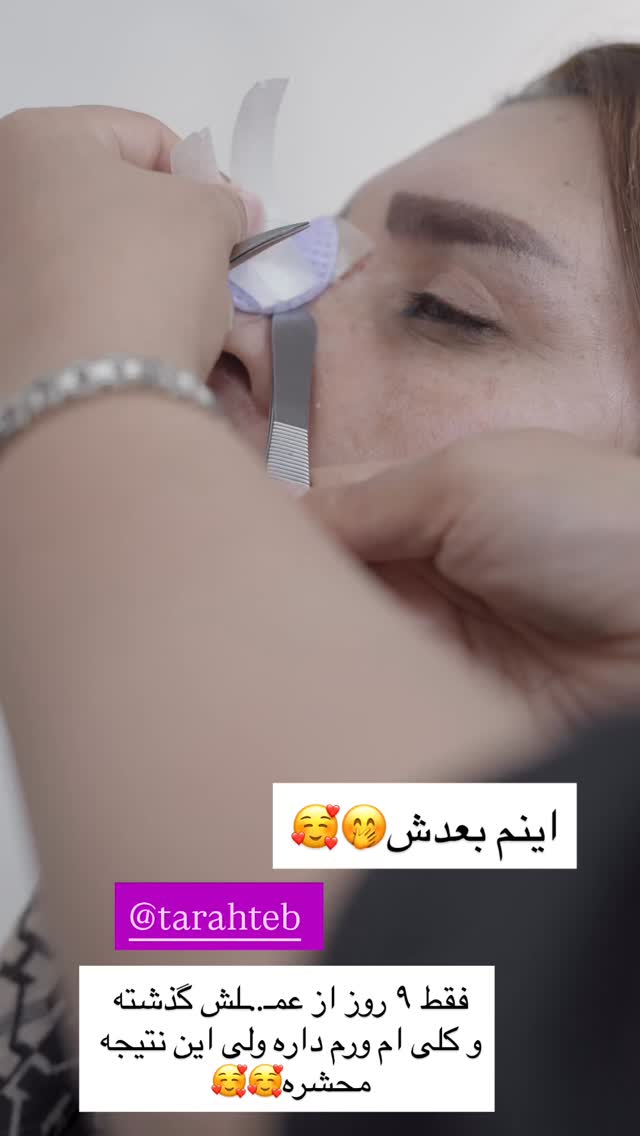  جدید ترین استوری اینستاگرام محی