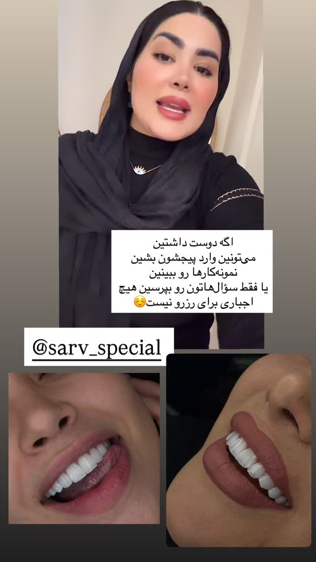  جدید ترین استوری اینستاگرام محی