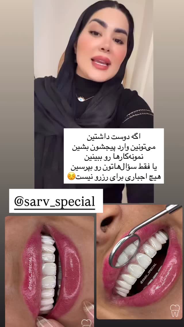  جدید ترین استوری اینستاگرام محی
