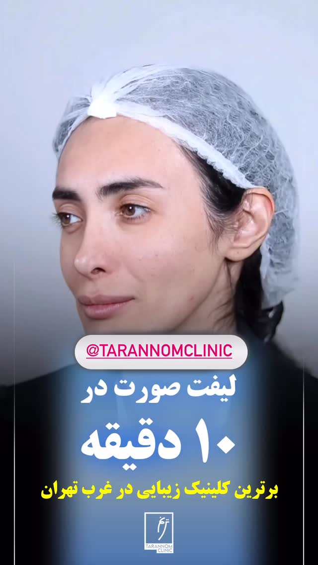  جدید ترین استوری اینستاگرام محی