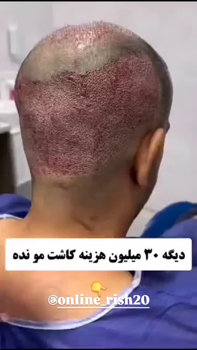  جدید ترین استوری اینستاگرام مختار سائقی
