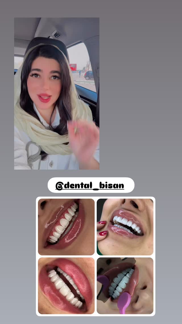  جدید ترین استوری اینستاگرام مونا