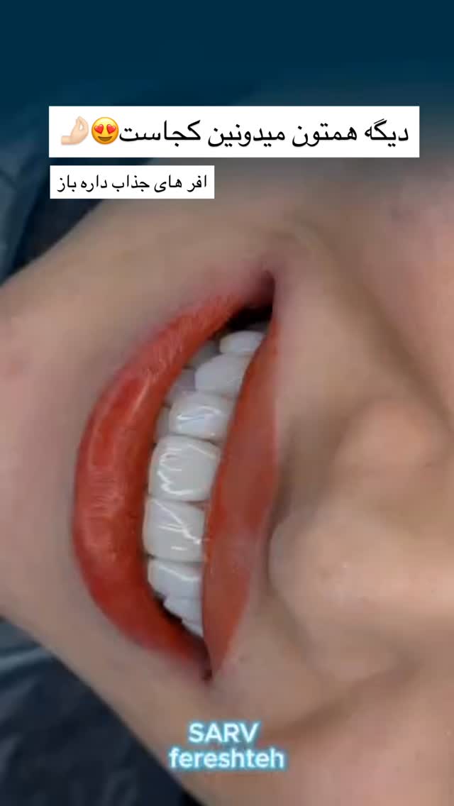  جدید ترین استوری اینستاگرام مونا