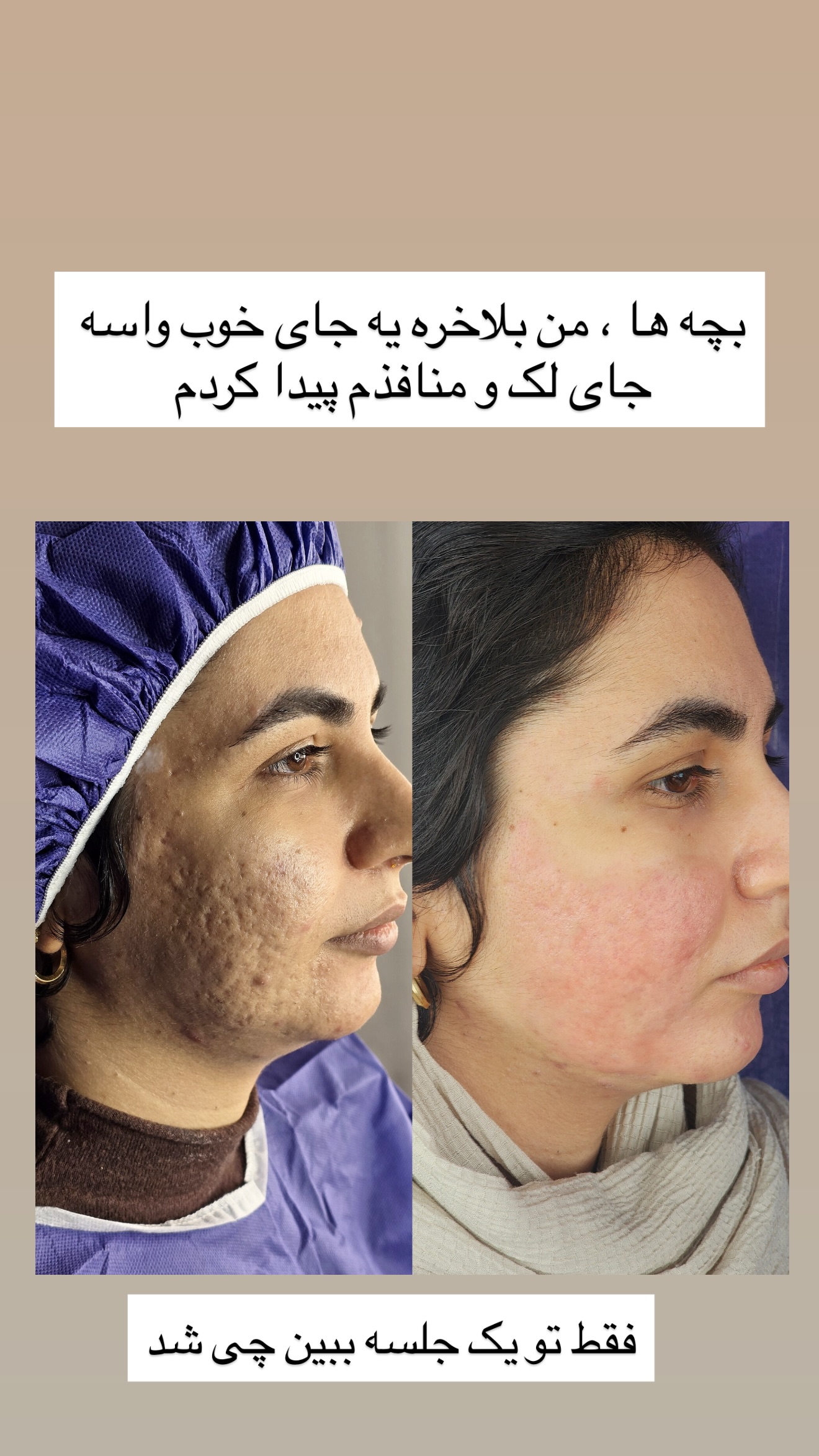  جدید ترین استوری اینستاگرام مونا