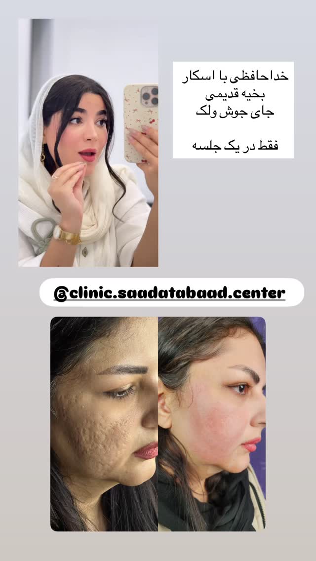  جدید ترین استوری اینستاگرام مونا