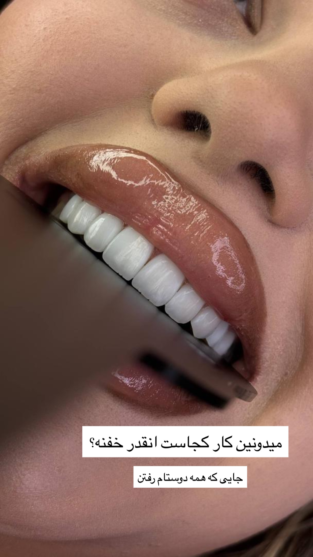  جدید ترین استوری اینستاگرام مونا