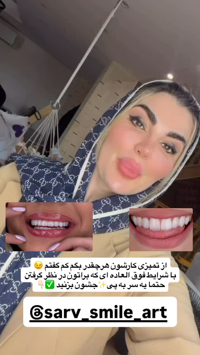  جدید ترین استوری اینستاگرام مونا دیلم کتولی