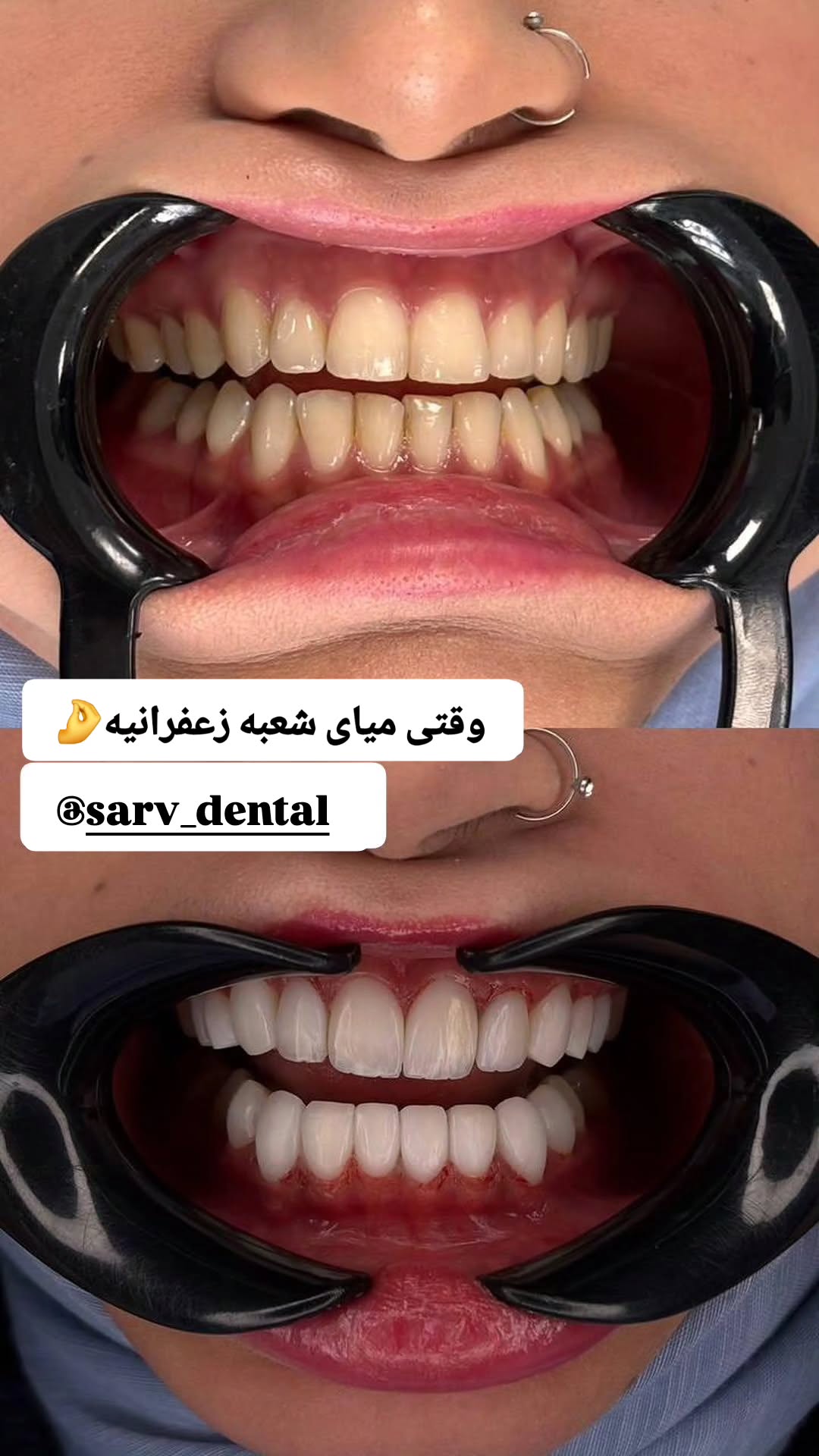  جدید ترین استوری اینستاگرام مروارید موجدی