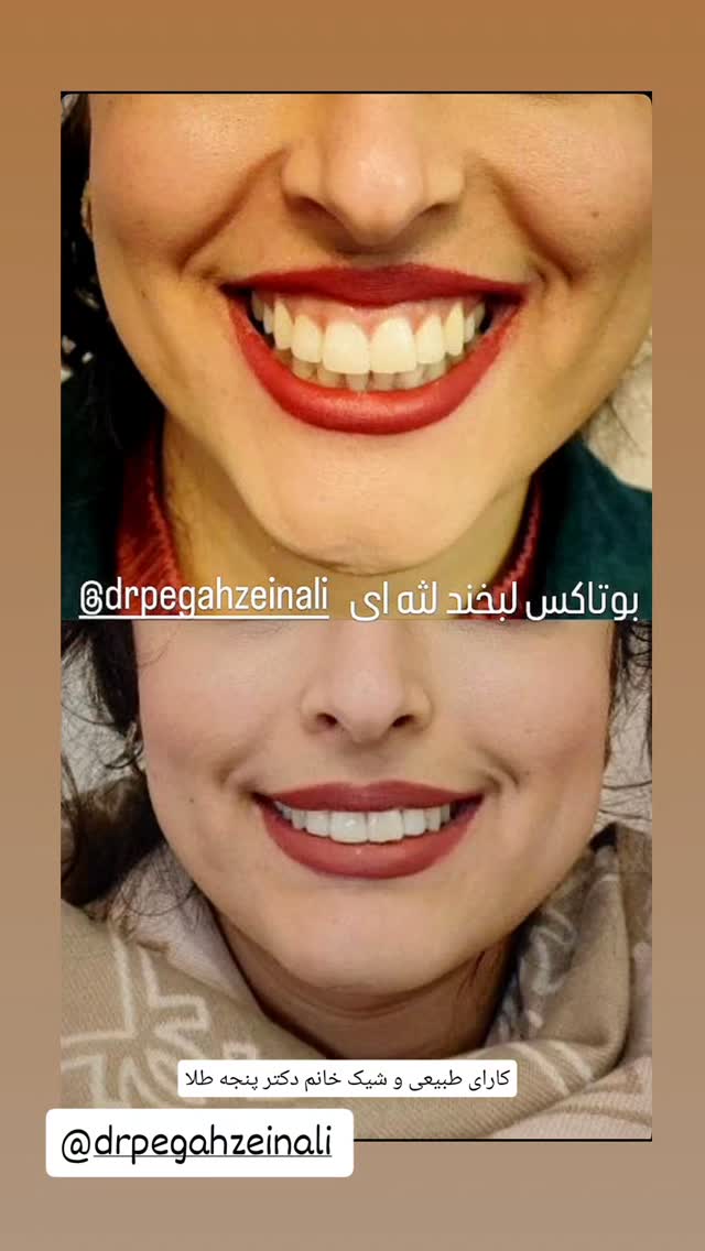  جدید ترین استوری اینستاگرام مروارید موجدی