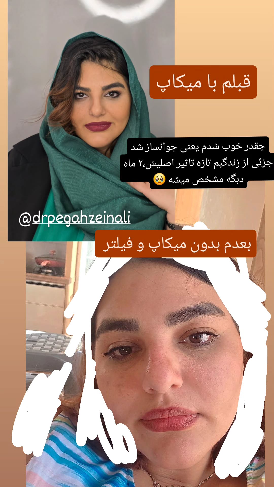  جدید ترین استوری اینستاگرام مروارید موجدی