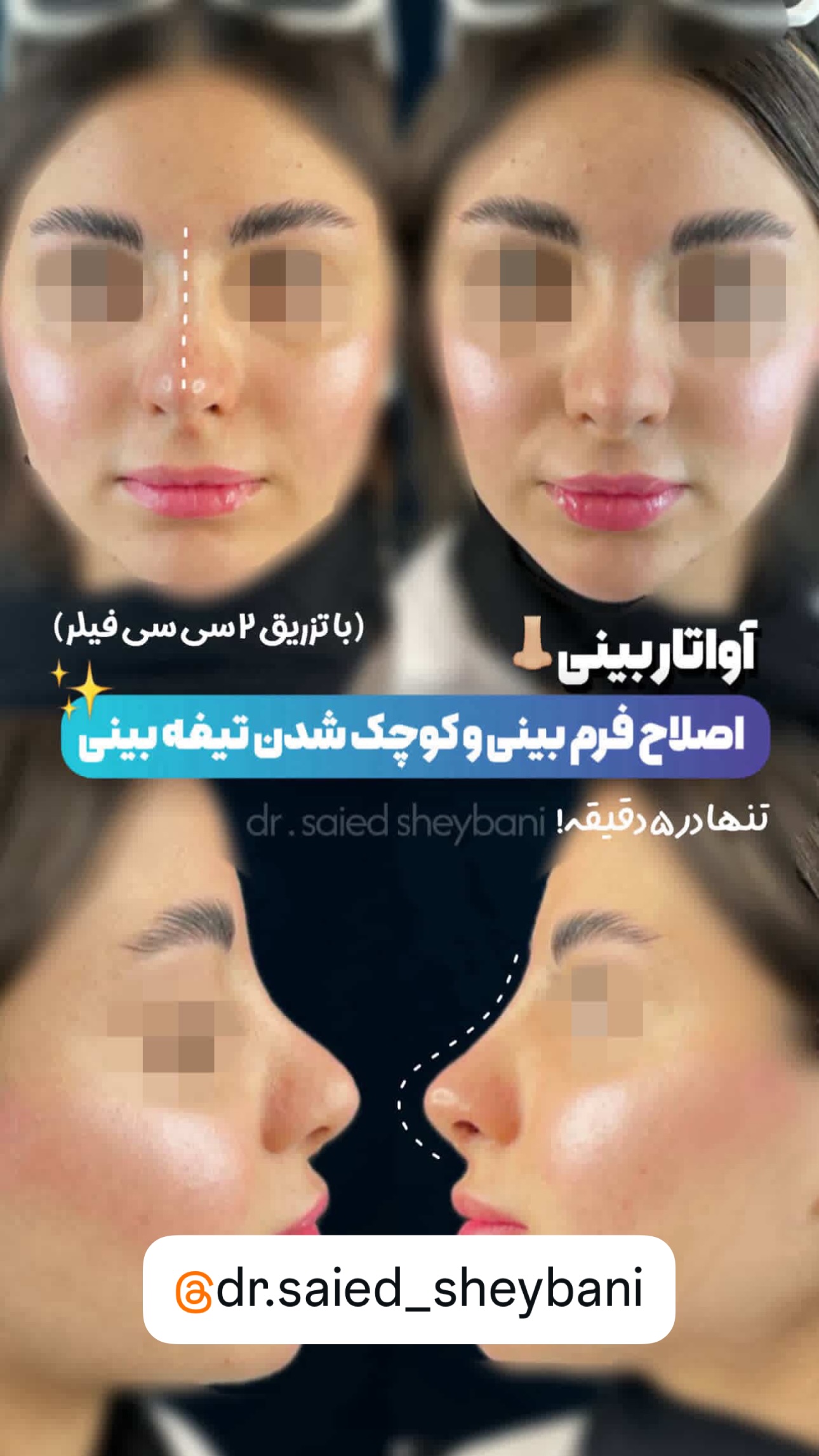  جدید ترین استوری اینستاگرام متین امینی