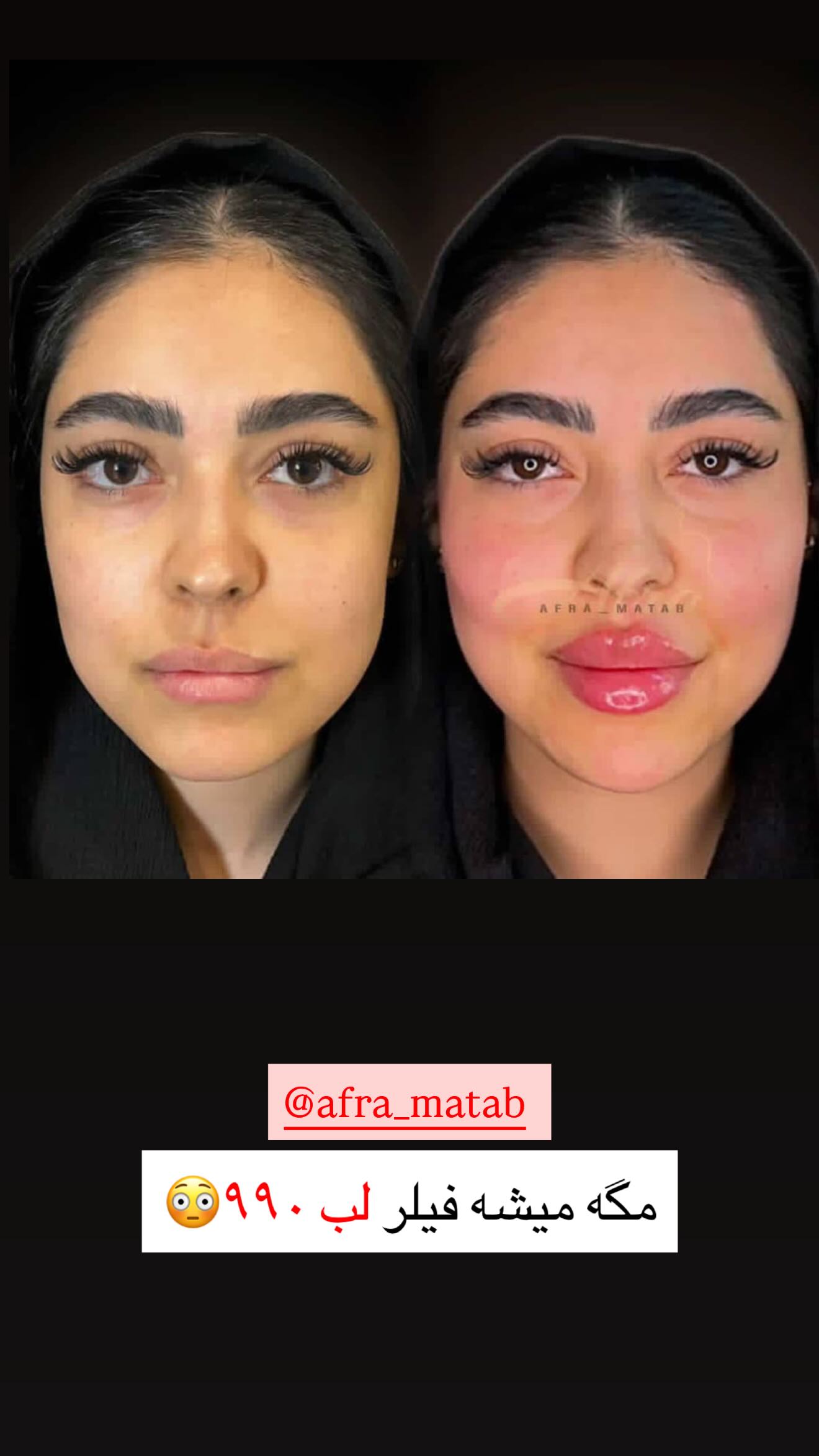 جدید ترین استوری اینستاگرام نسیم بهادورنیا