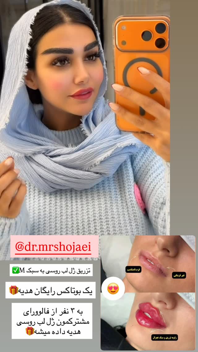  جدید ترین استوری اینستاگرام نسیم بهادورنیا