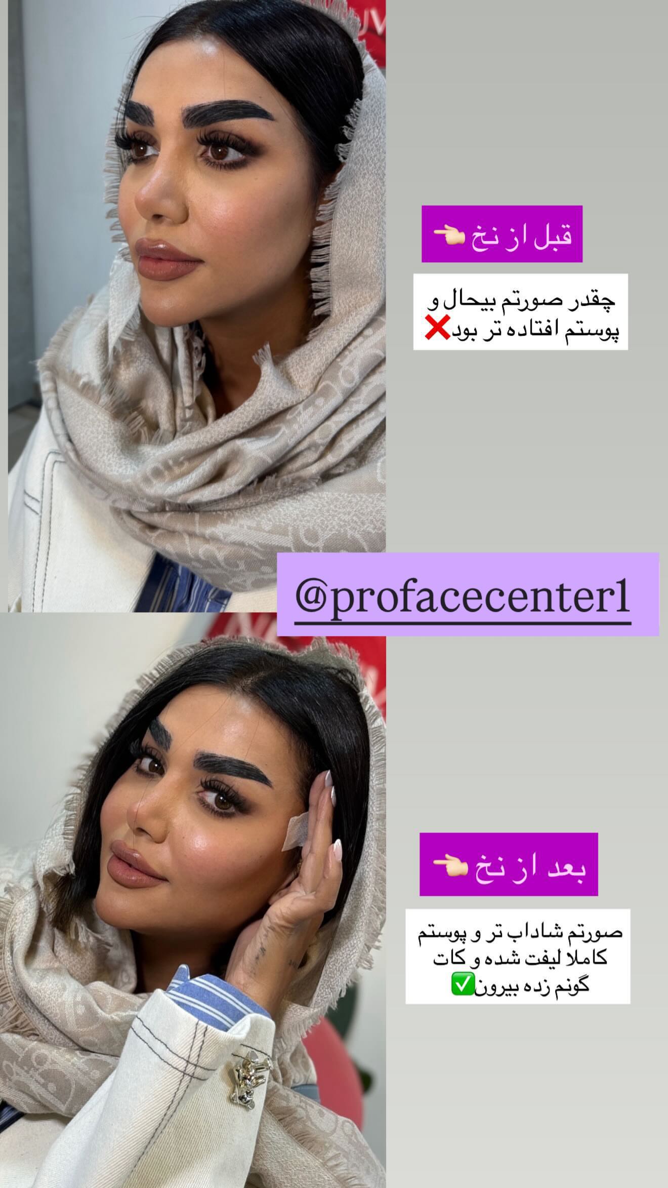  جدید ترین استوری اینستاگرام نسیم بهادورنیا