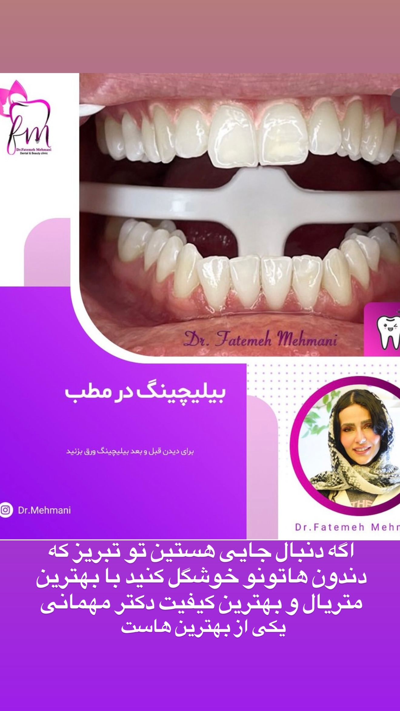  جدید ترین استوری اینستاگرام نسترن (خانواده تبریزی)