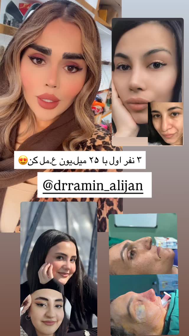  جدید ترین استوری اینستاگرام نسترن اکبری