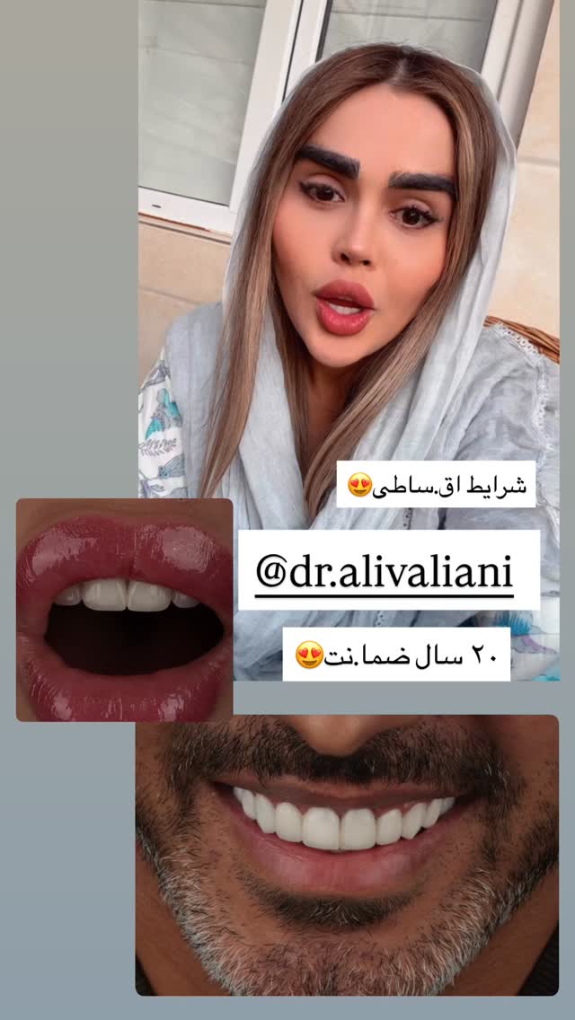  جدید ترین استوری اینستاگرام نسترن اکبری