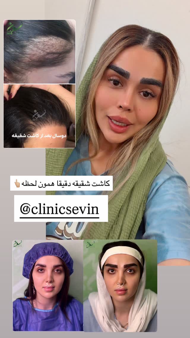  جدید ترین استوری اینستاگرام نسترن اکبری