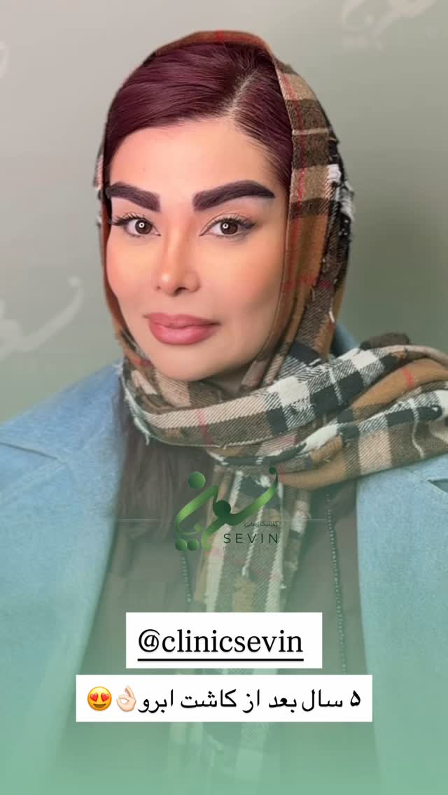  جدید ترین استوری اینستاگرام نسترن اکبری