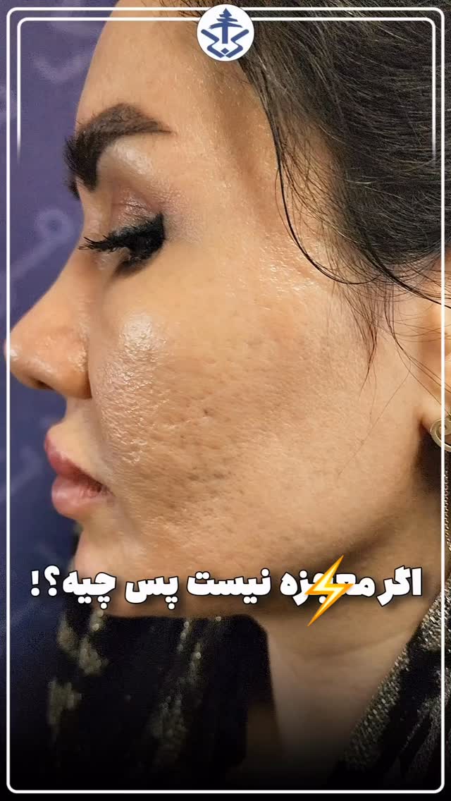  جدید ترین استوری اینستاگرام نسترن اکبری