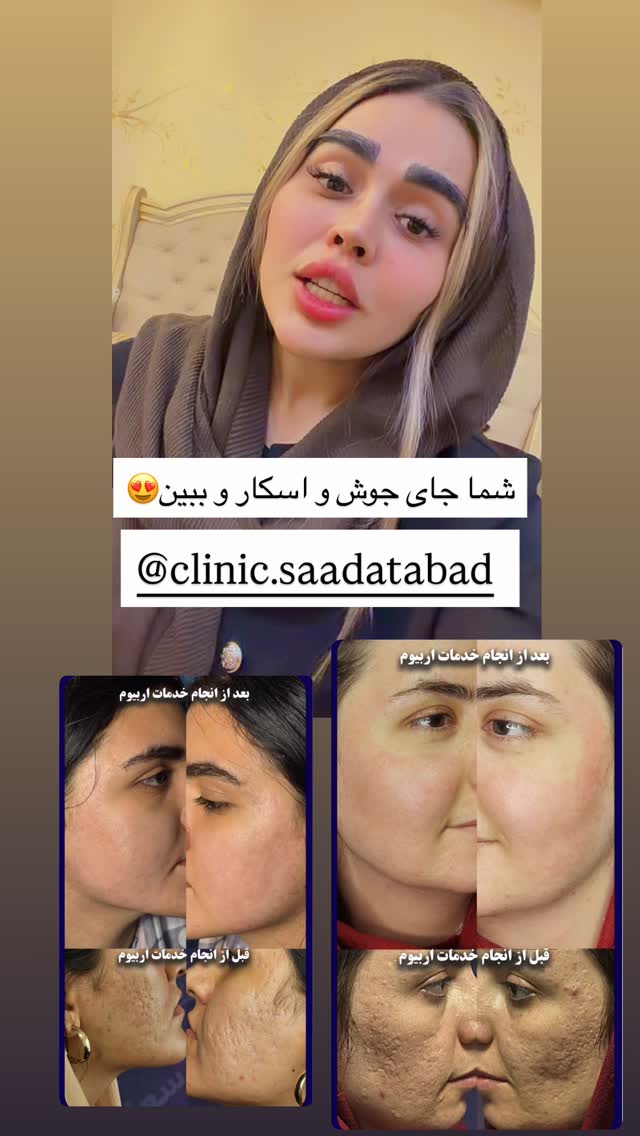  جدید ترین استوری اینستاگرام نسترن اکبری
