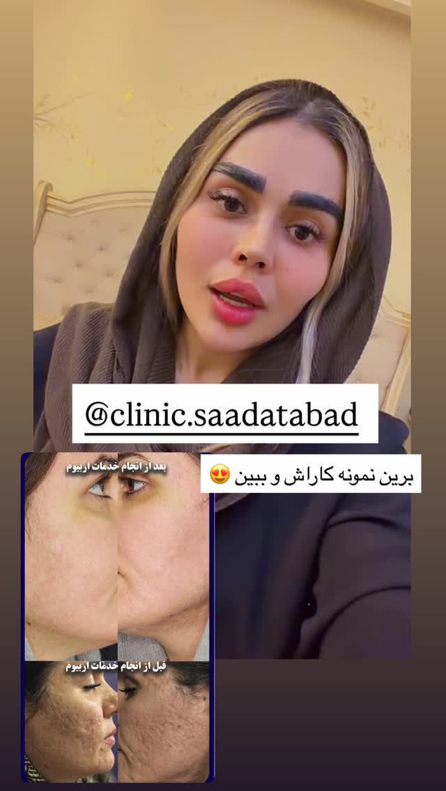 جدید ترین استوری اینستاگرام نسترن اکبری