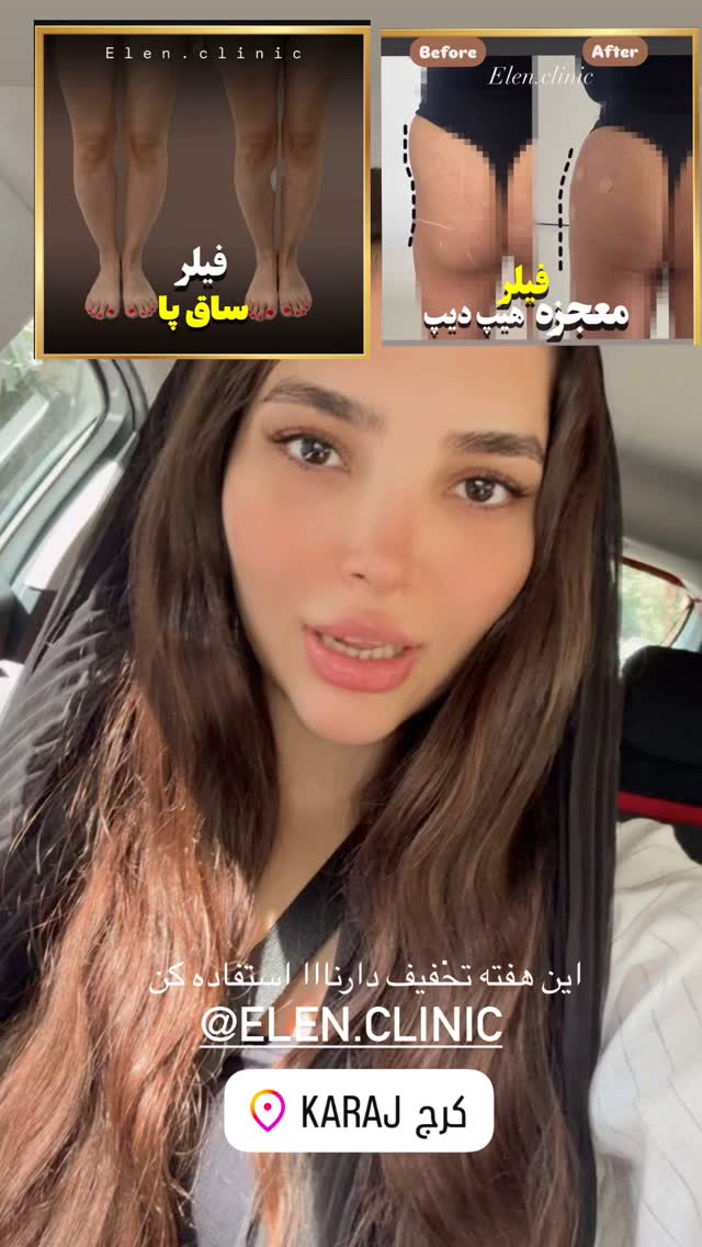  جدید ترین استوری اینستاگرام نازنین بهبودی