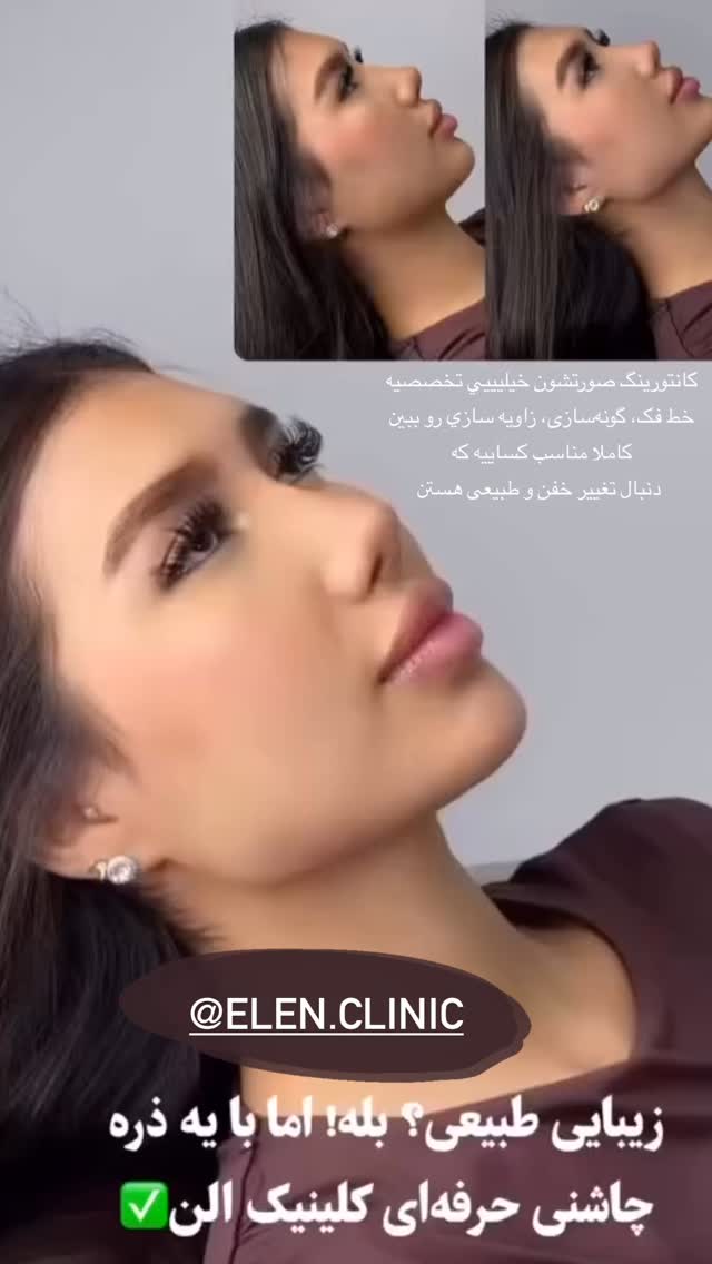  جدید ترین استوری اینستاگرام نازنین بهبودی