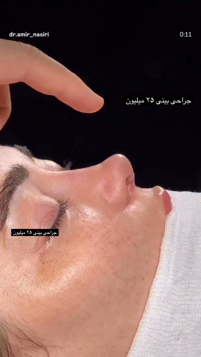  جدید ترین استوری اینستاگرام نازنین بهبودی