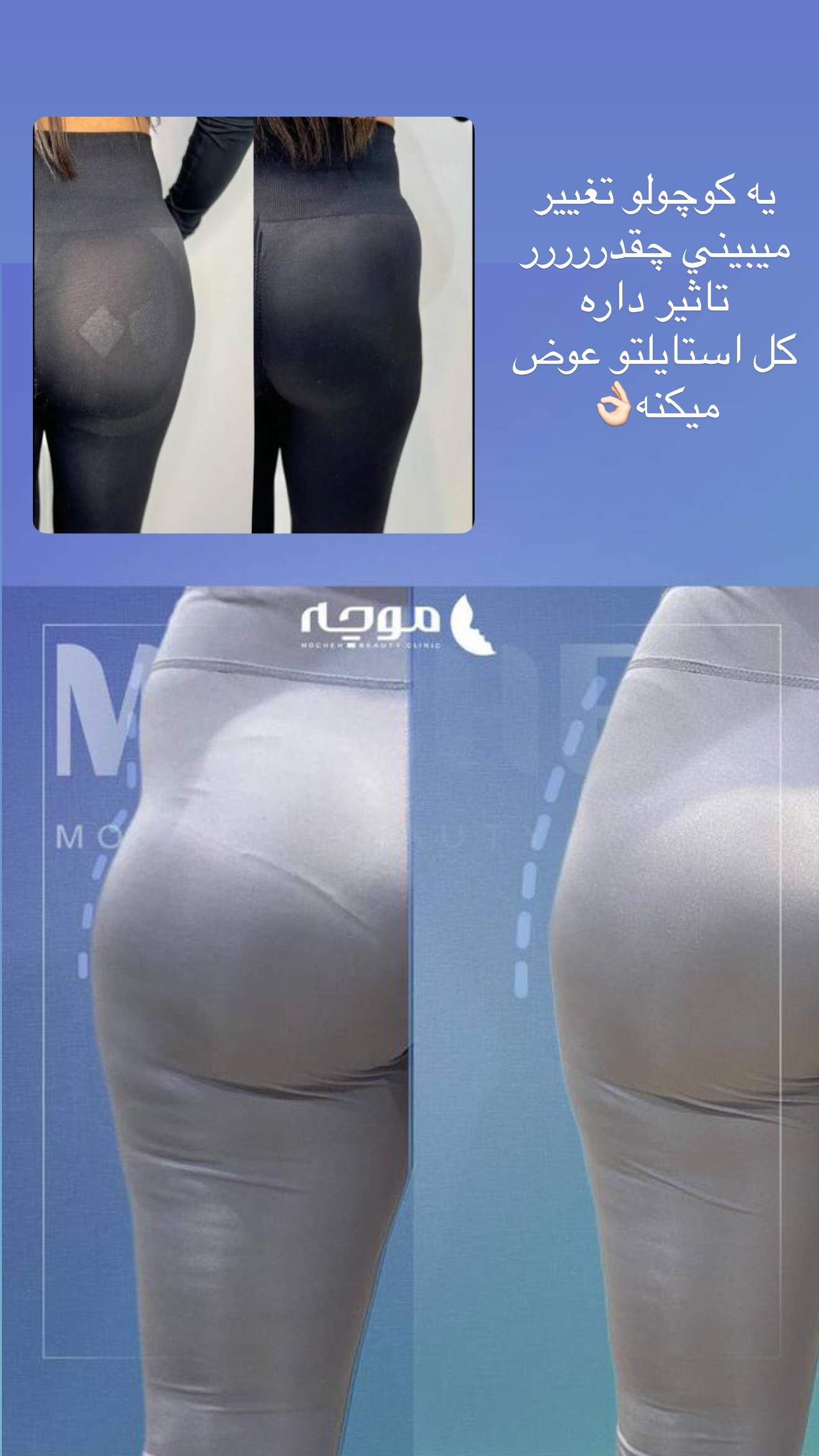  جدید ترین استوری اینستاگرام نازنین بهبودی
