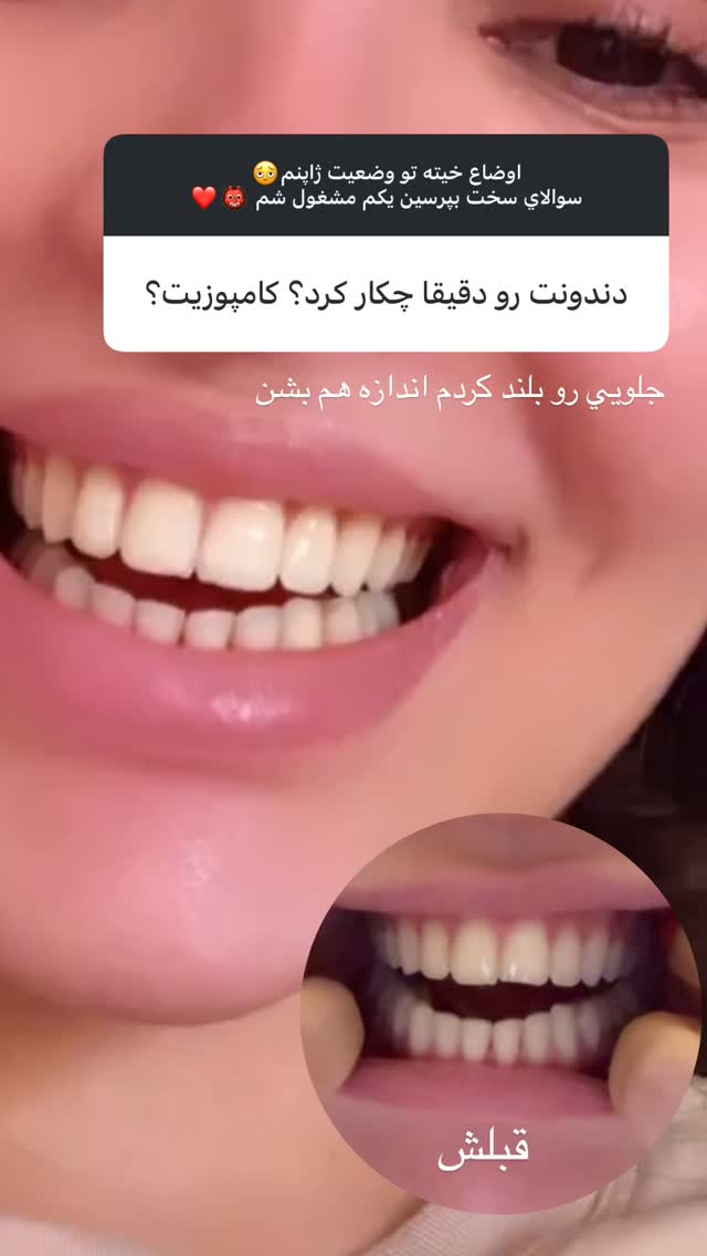  جدید ترین استوری اینستاگرام نازنین بهبودی