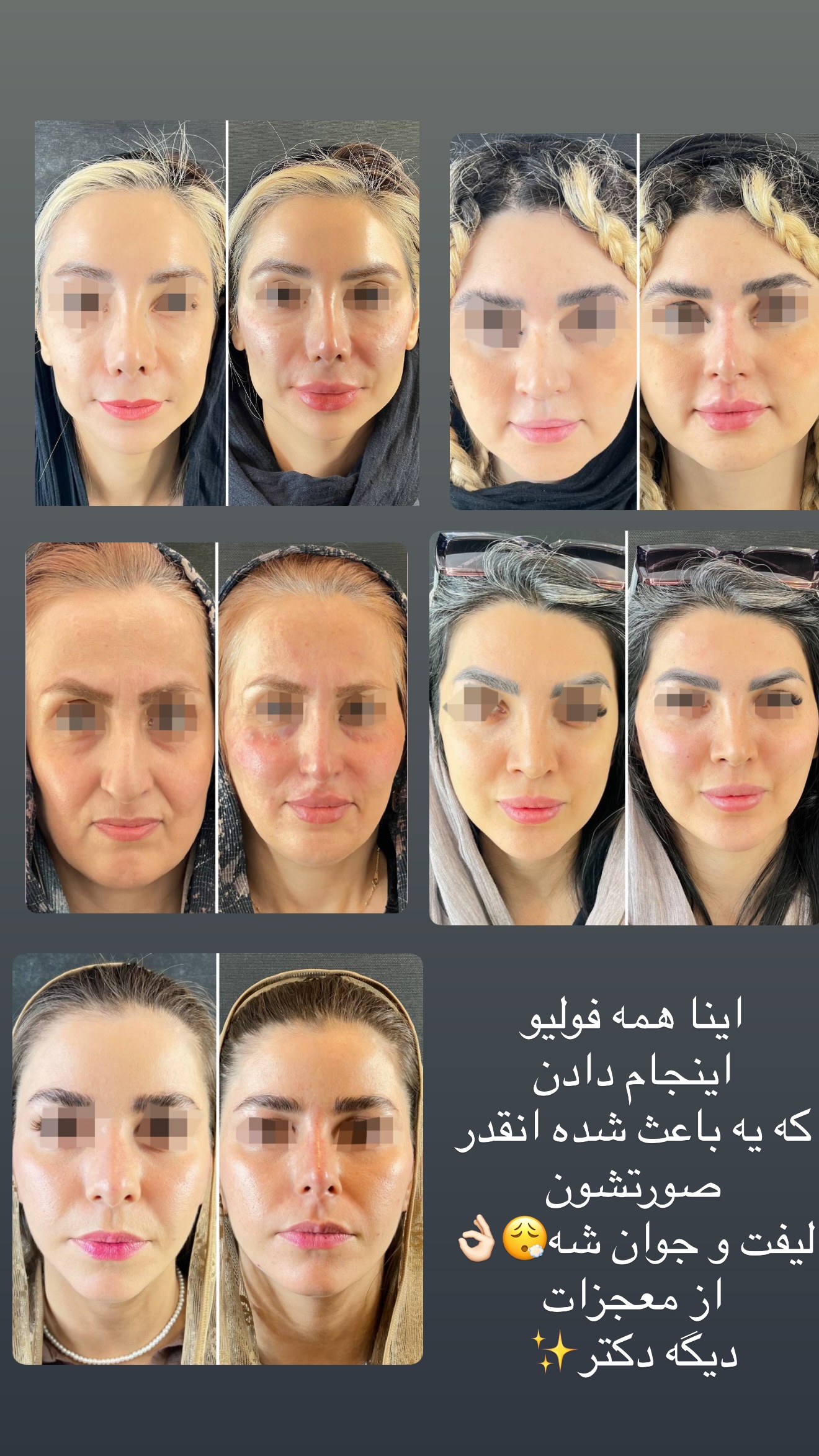  جدید ترین استوری اینستاگرام نازنین بهبودی