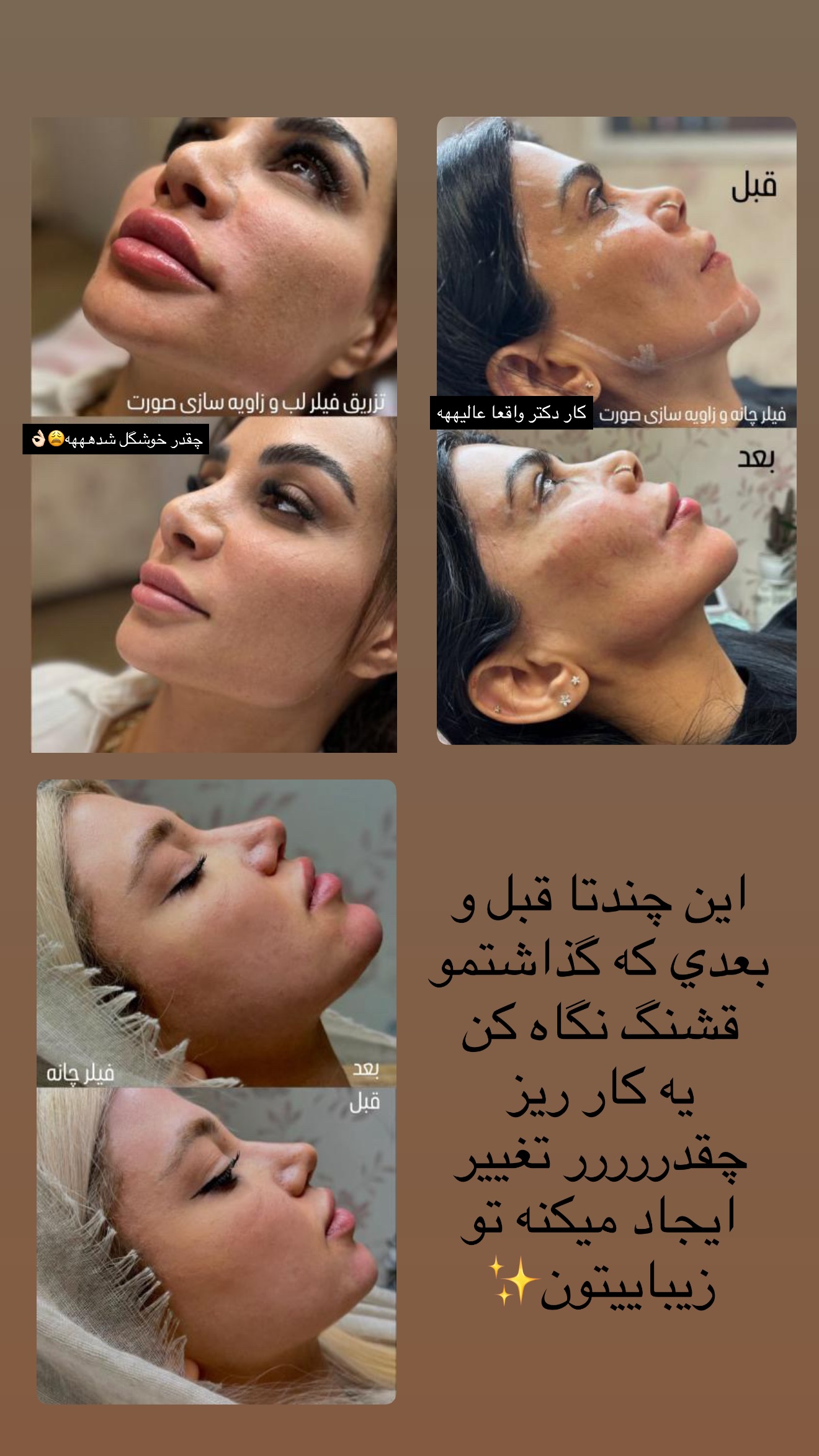  جدید ترین استوری اینستاگرام نازنین بهبودی