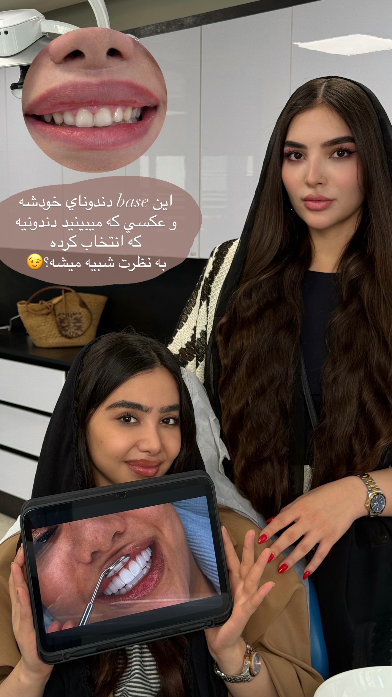  جدید ترین استوری اینستاگرام نازنین بهبودی