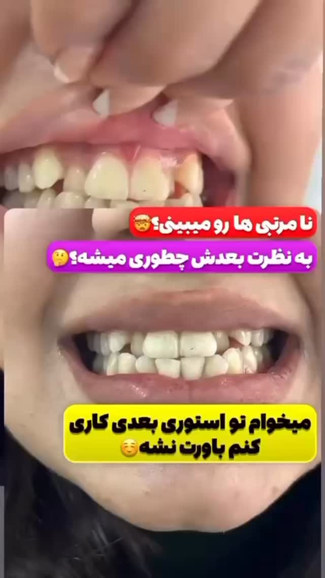  جدید ترین استوری اینستاگرام نازنین بهبودی