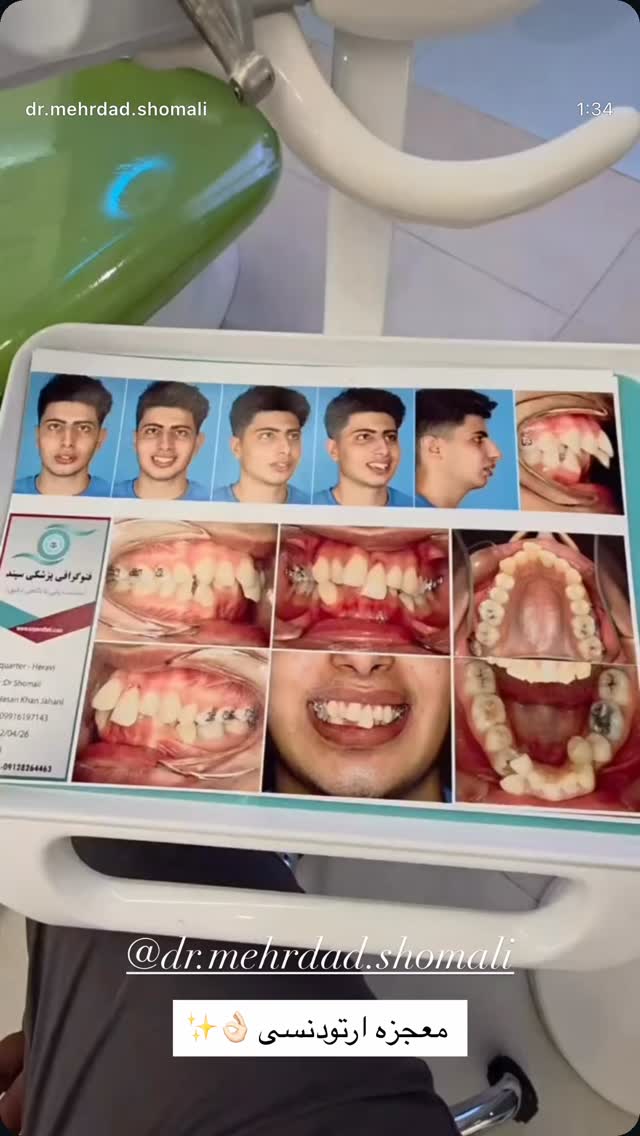  جدید ترین استوری اینستاگرام نازنین بهبودی