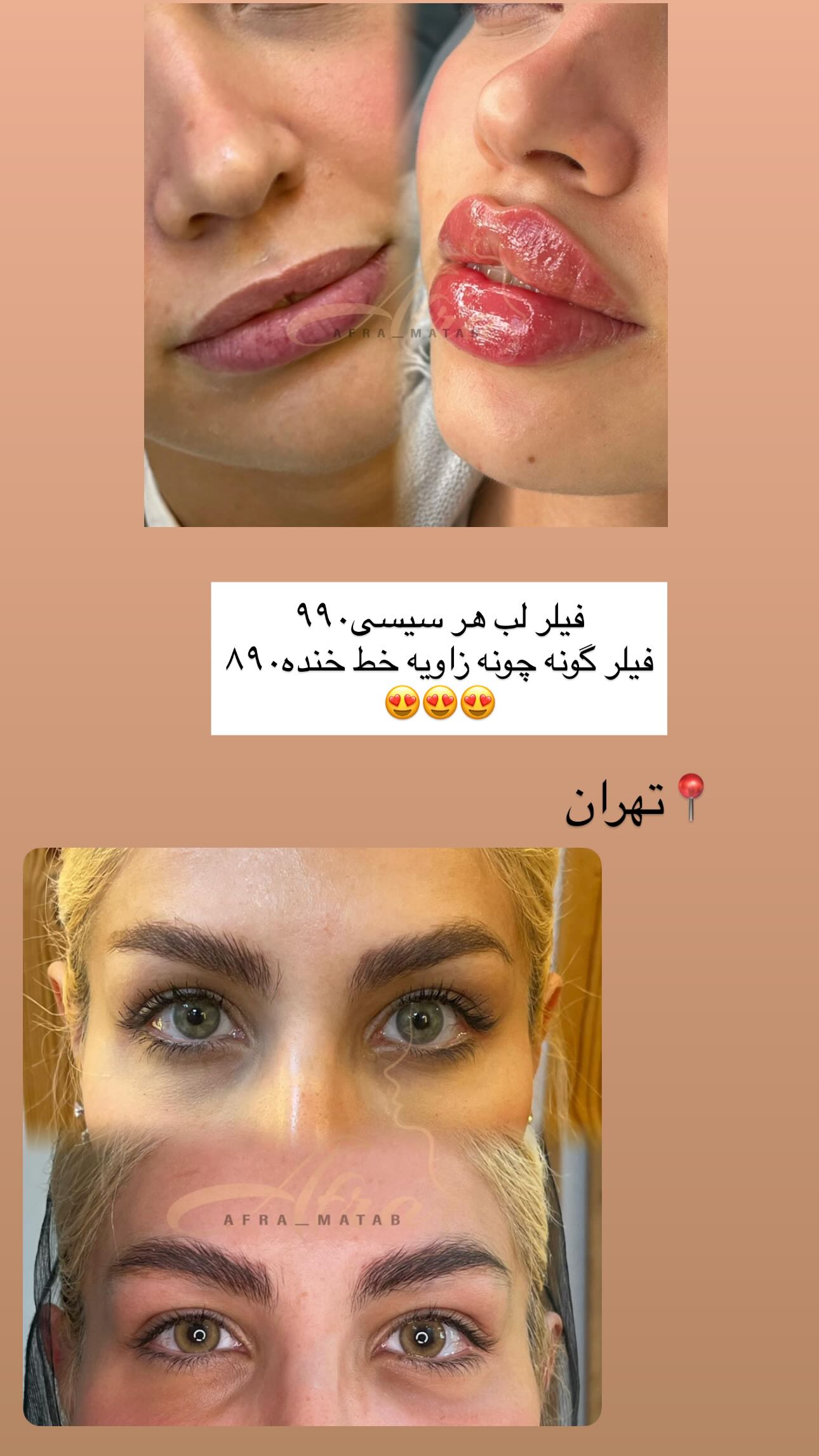  جدید ترین استوری اینستاگرام ندا (مامان فرفری)