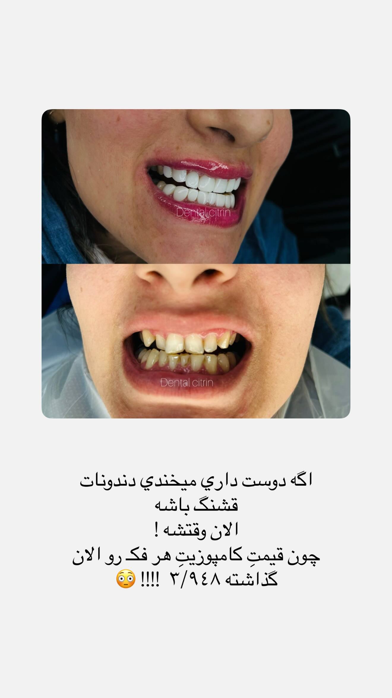  جدید ترین استوری اینستاگرام نگين عابدزاده
