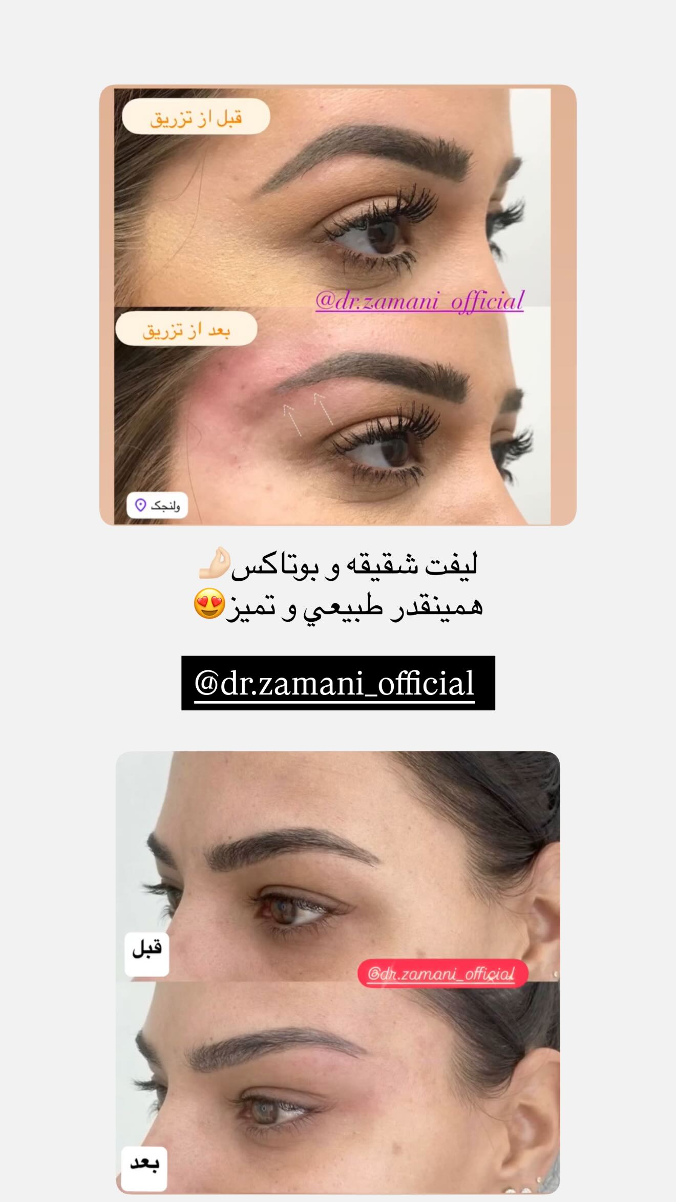  جدید ترین استوری اینستاگرام نگين عابدزاده