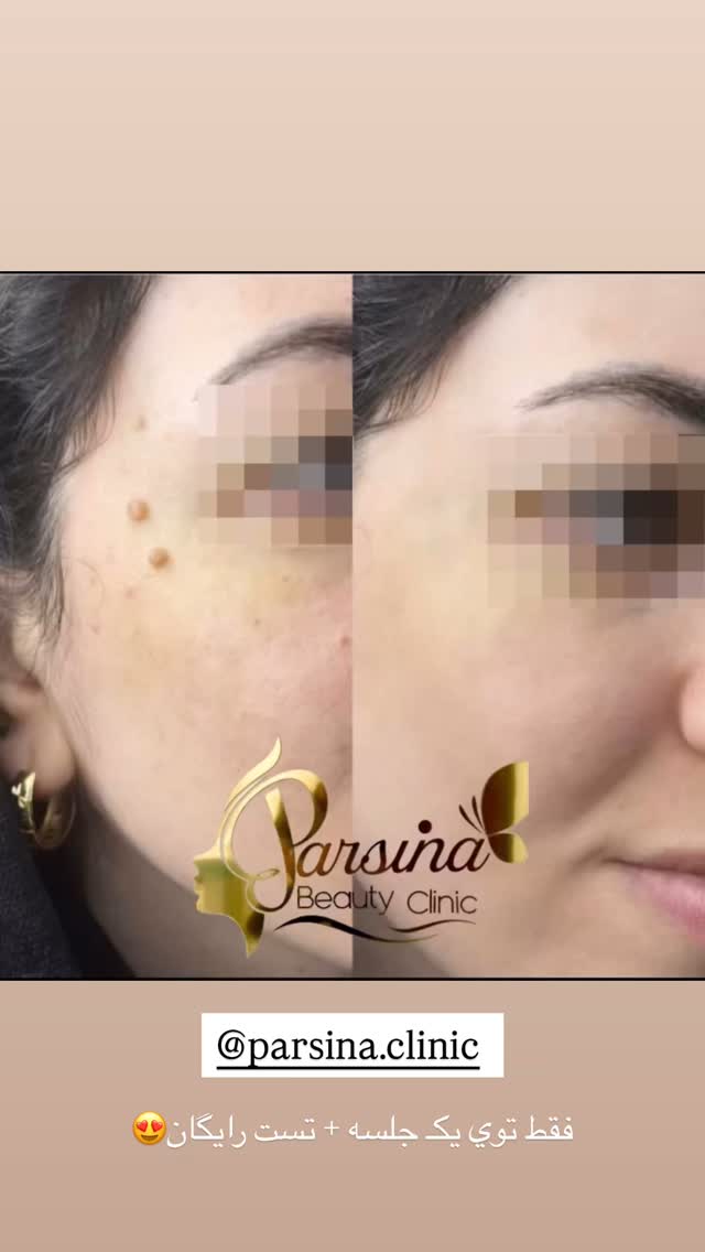  جدید ترین استوری اینستاگرام نگين عابدزاده