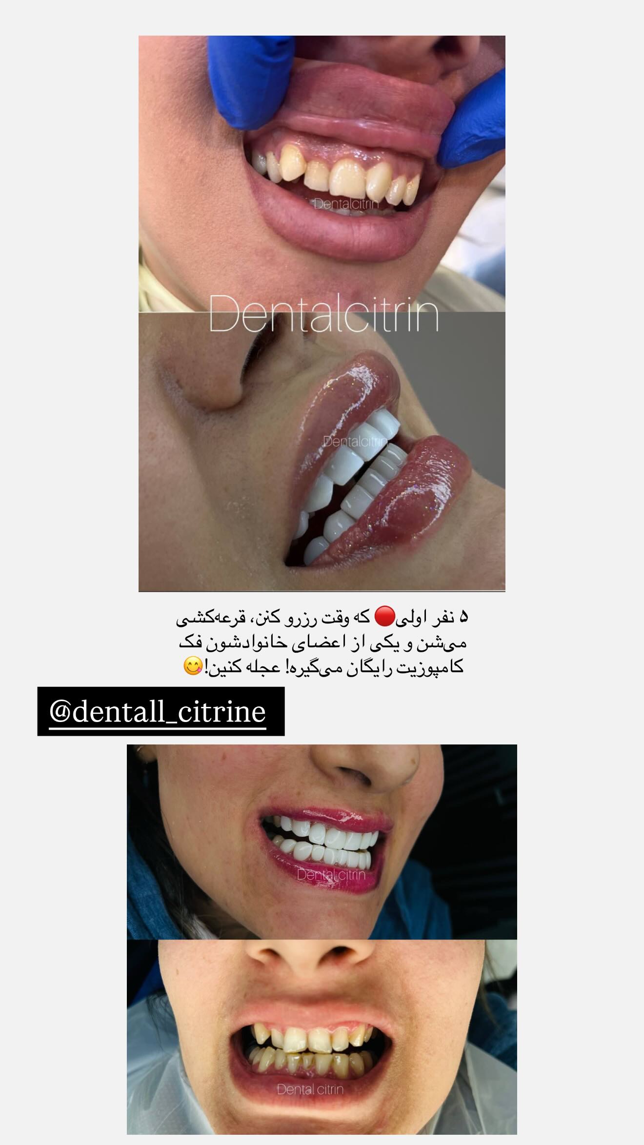  جدید ترین استوری اینستاگرام نگين عابدزاده