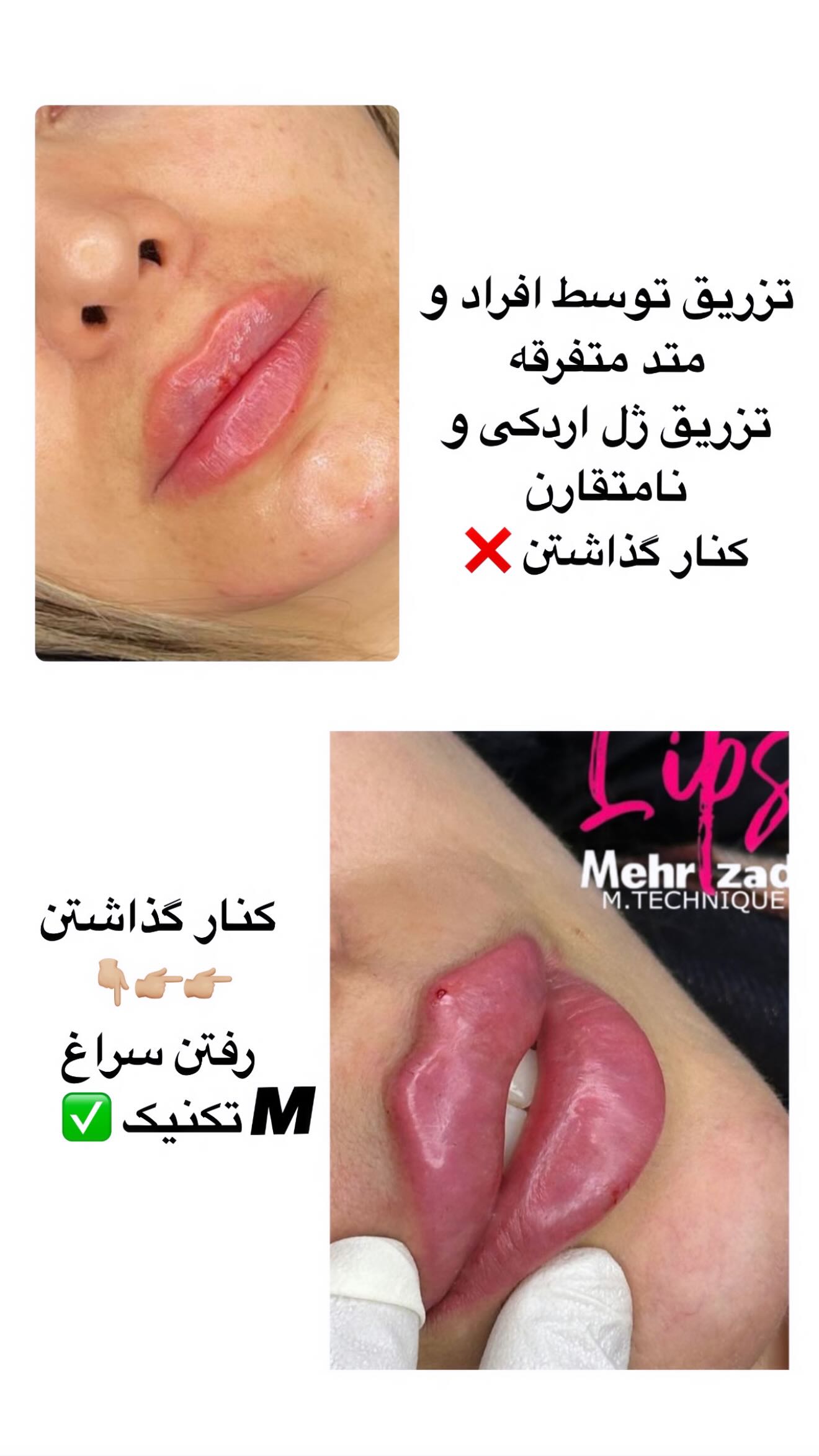  جدید ترین استوری اینستاگرام نگين عابدزاده