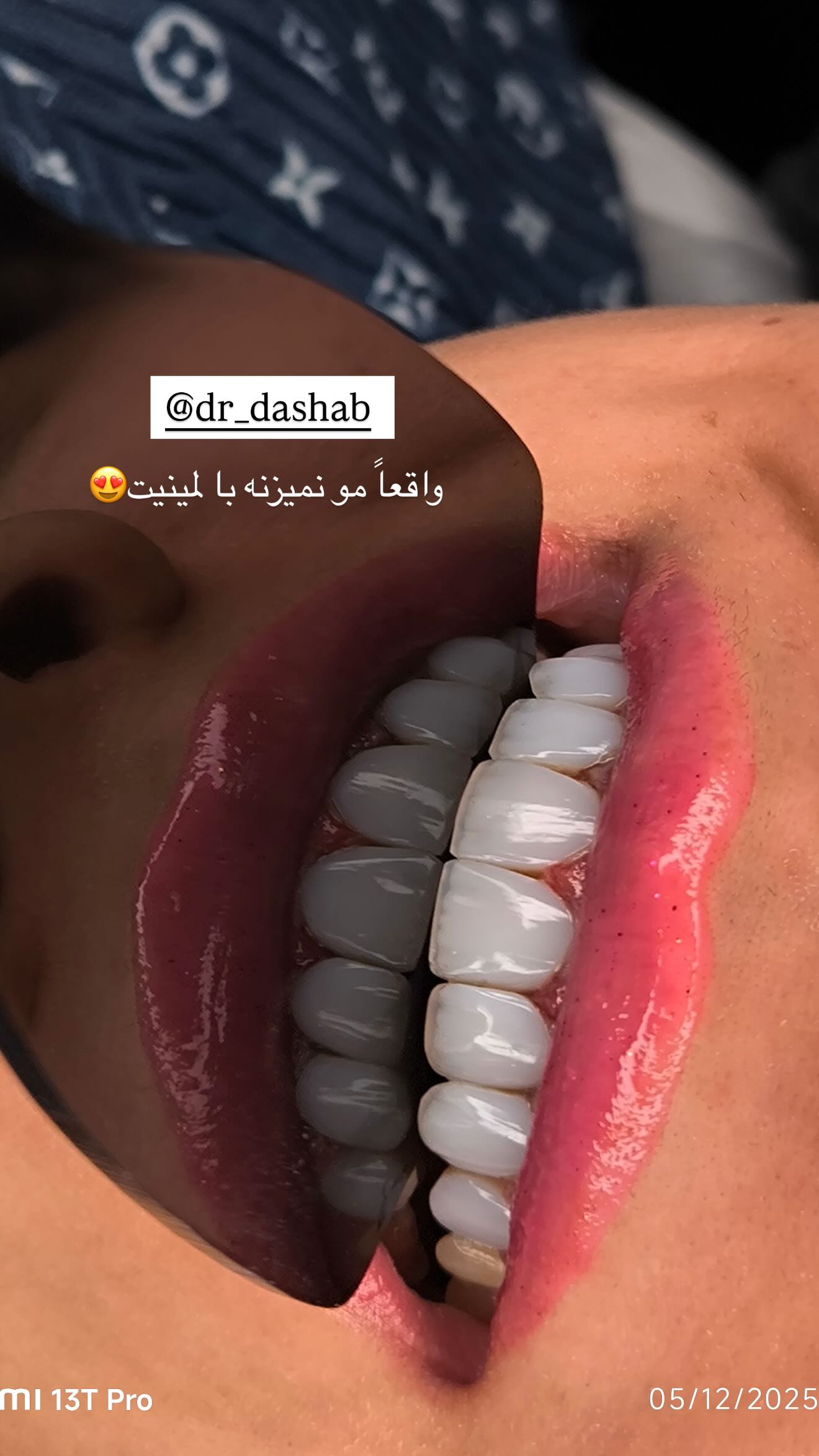  جدید ترین استوری اینستاگرام نگين عابدزاده
