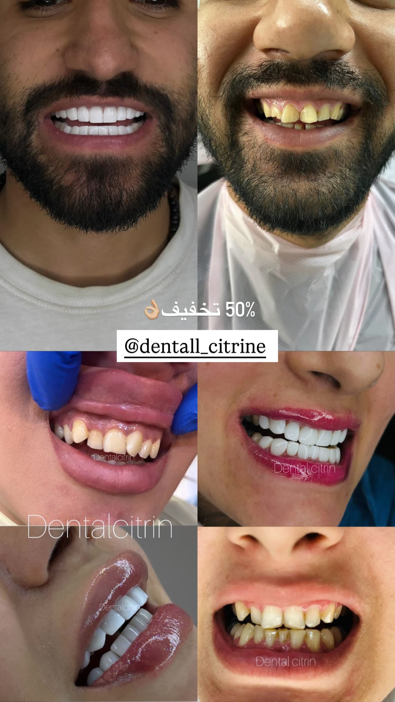  جدید ترین استوری اینستاگرام نگين عابدزاده