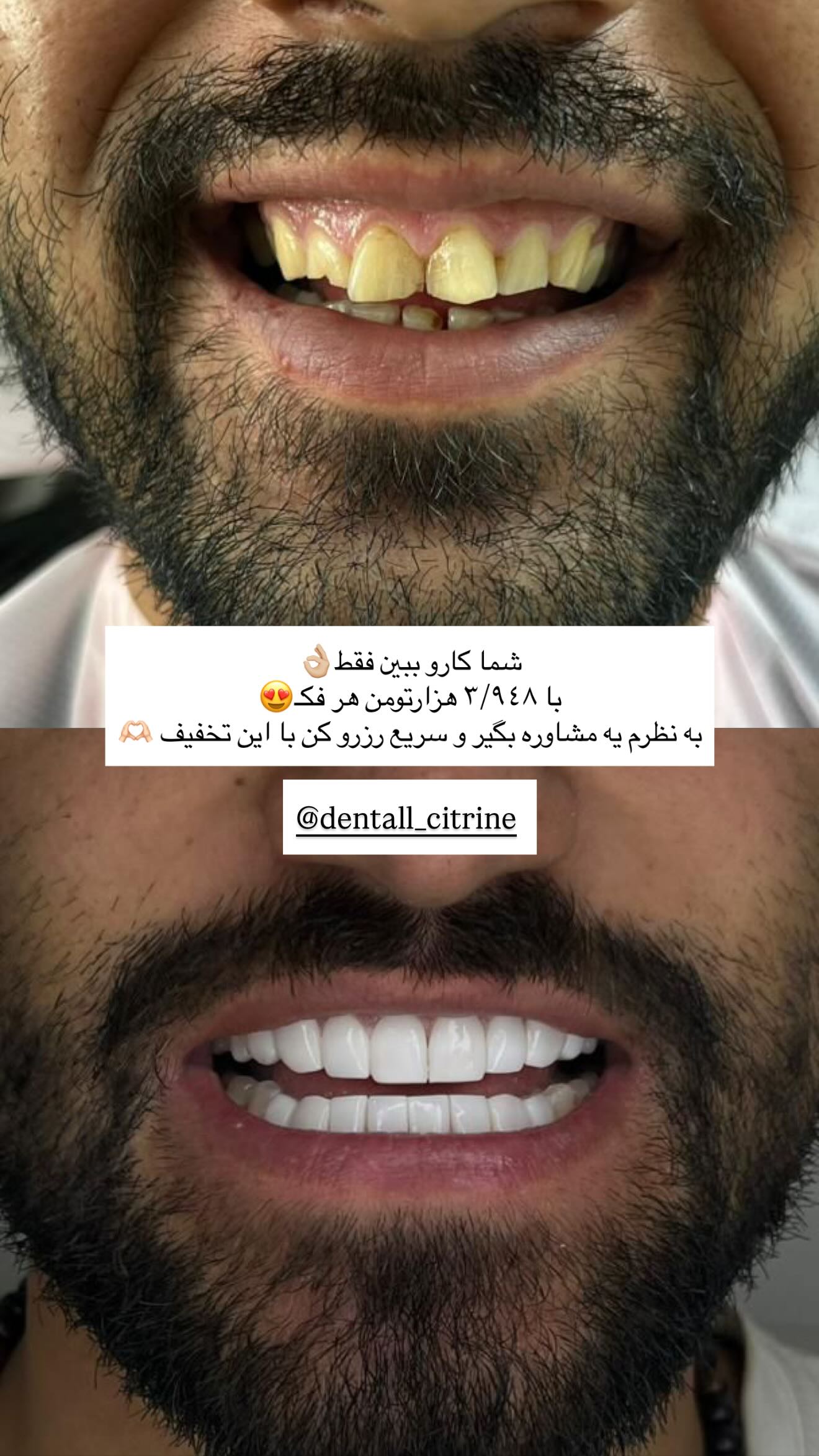  جدید ترین استوری اینستاگرام نگين عابدزاده